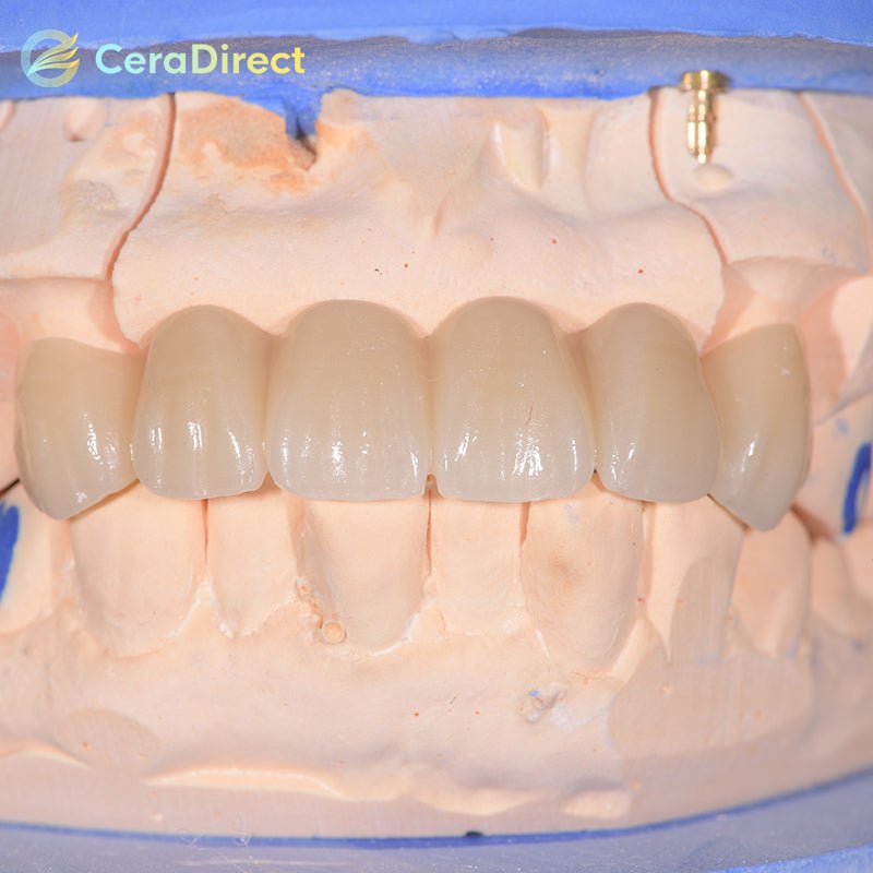 3D Pro—Multilayer Zirconia Disc Open System (98mm)A1-B4 - CeraDirect