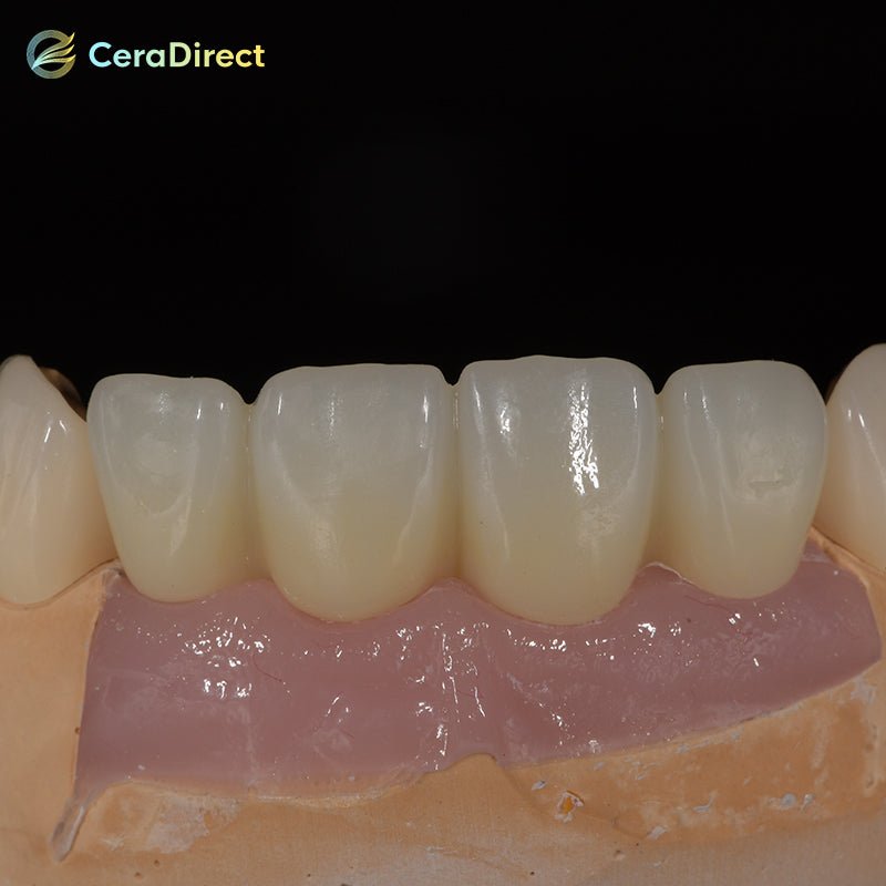 3D Pro—Multilayer Zirconia Disc Open System (98mm)A1-B4 - CeraDirect
